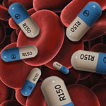Gastrointestinal Bleeding from Pradaxa