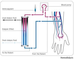 GranuFlo and dialysis injury diagram